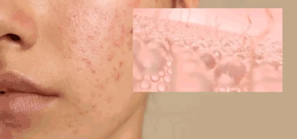 [티벳동생 공동개발] 오아조 피디알엔 쓰리디 부스팅 앰플 30ml 상세페이지 8